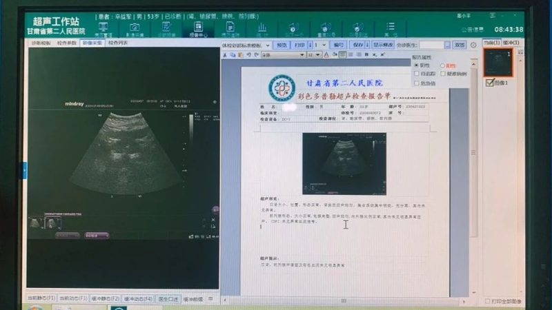 北京体检套餐怎么比才真划算